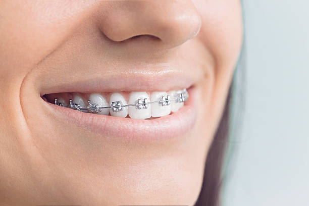 Best Traditional Braces  in New Holstein, WI